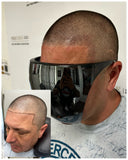 Hairline Restoration Bundle